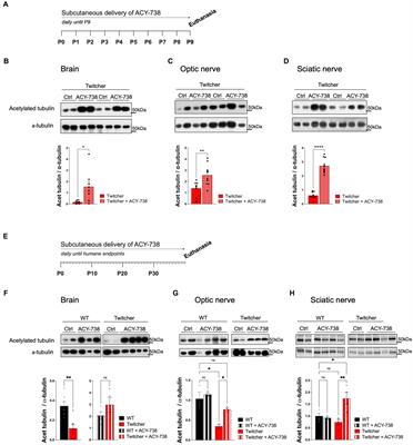HDAC-6 inhibition ameliorates the early neuropathology in a mouse model of Krabbe disease